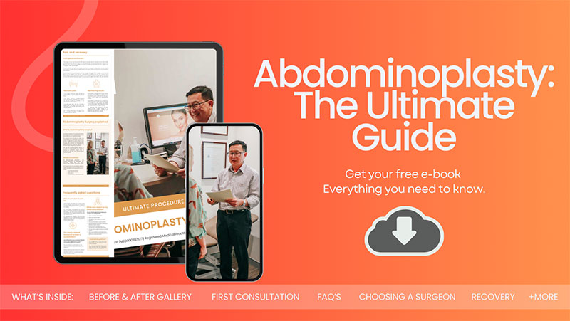 Abdominoplasty Guide