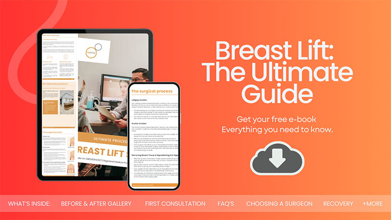 Breast Lift Guide