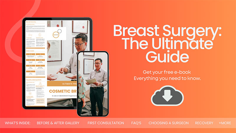Breast Surgery Guide