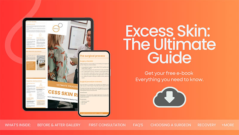 Excess Skin Guide
